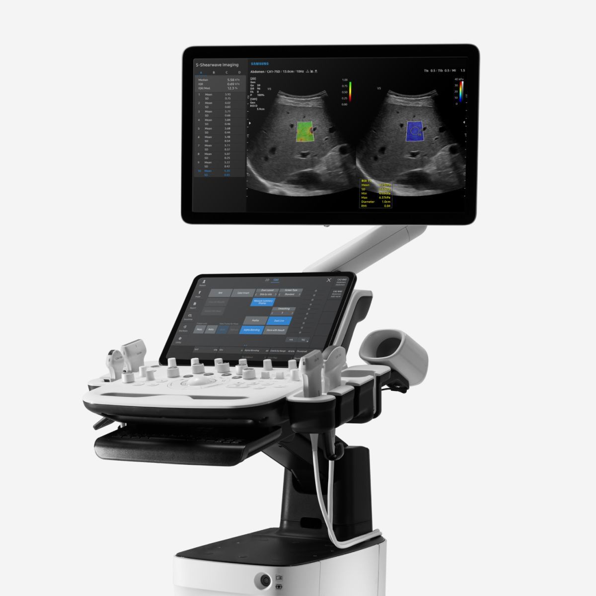 V5 — Ultrasonido diagnóstico de consola con IA