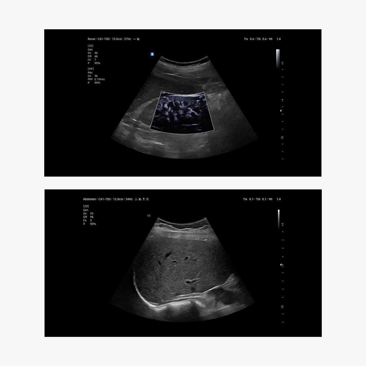 V5 — Ultrasonido diagnóstico de consola con IA