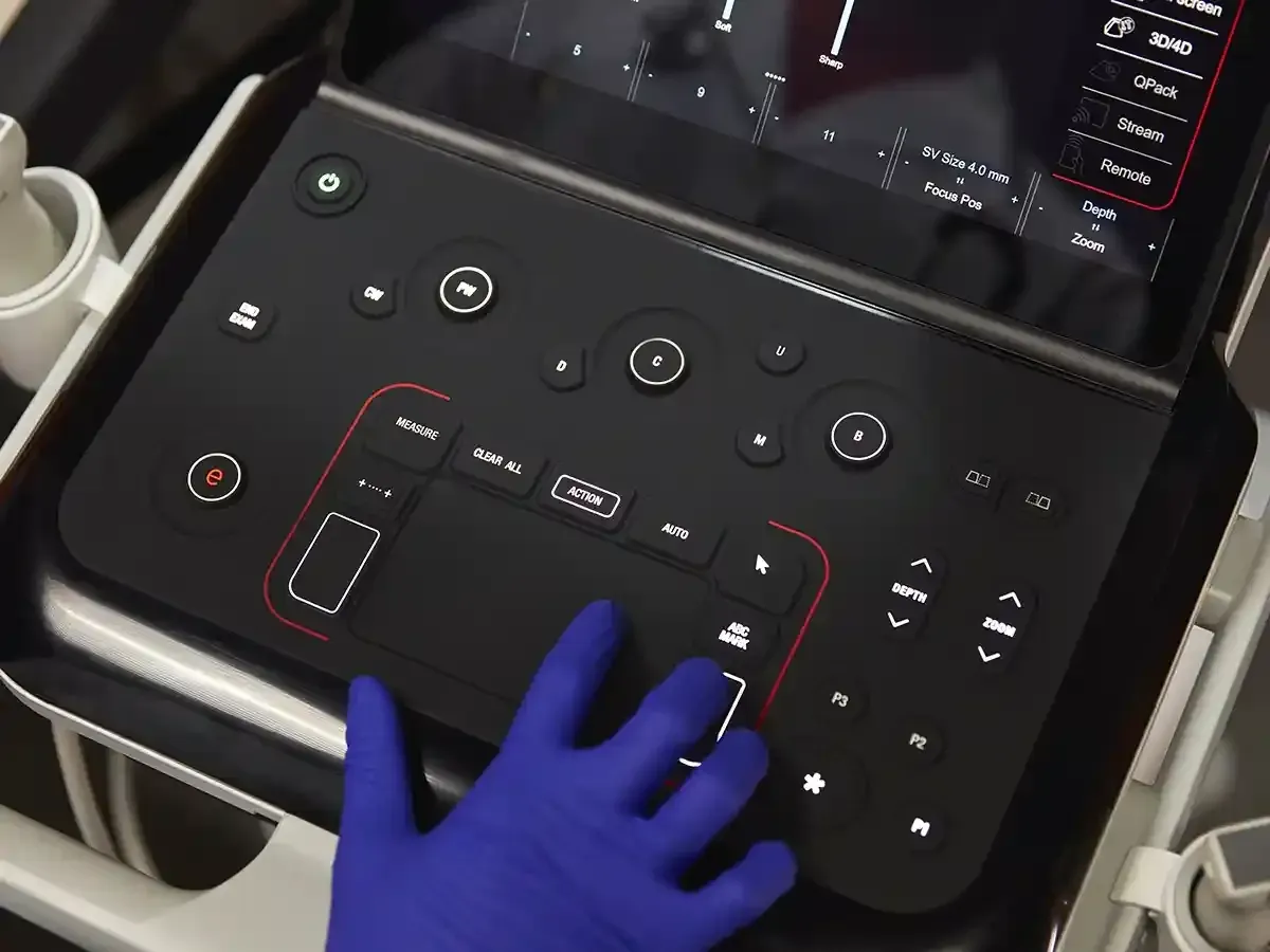 MyLab A70 – Ecografía de alto rendimiento