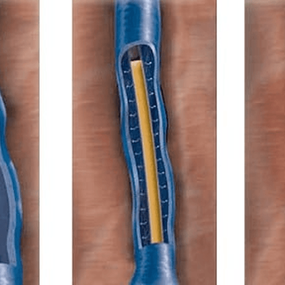 Consumibles para Vascular