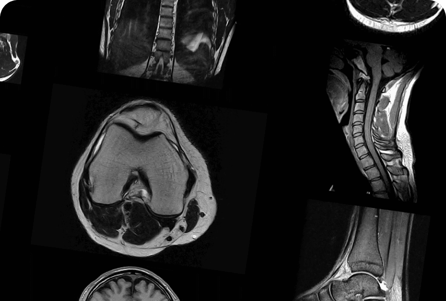 Ultrasonido vascular y evaluación clínica versátil