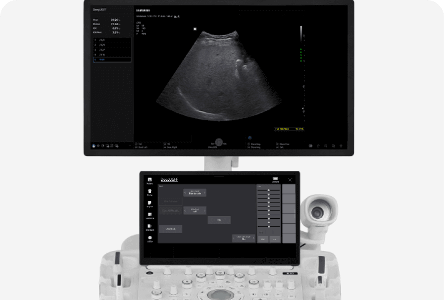 Ultrasonido versátil para evaluación vascular